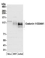 Codanin 1/CDAN1 Antibody in Western Blot (WB)