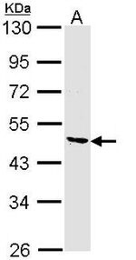 COL6A2 Antibody in Western Blot (WB)
