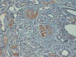 Complement C4d Antibody in Immunohistochemistry (Paraffin) (IHC (P))