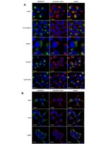 OxPhos Complex IV subunit IV Antibody in Immunocytochemistry (ICC/IF)