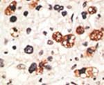Connexin 31 Antibody in Immunohistochemistry (IHC)
