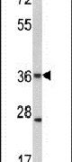 Connexin 31 Antibody in Western Blot (WB)