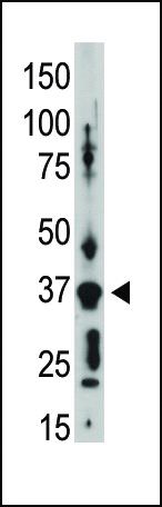 Connexin 36 Antibody in Western Blot (WB)