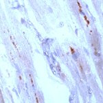 Connexin 43 Antibody in Immunohistochemistry (IHC)