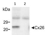 Connexin 26 Monoclonal Antibody (CX-12H10)