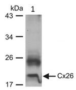 Connexin 26 Antibody in Western Blot (WB)