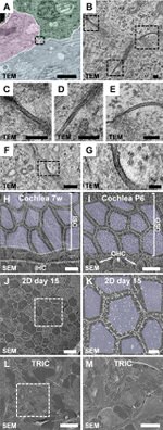 Connexin 30 Antibody in Immunohistochemistry (IHC)