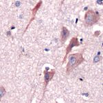 CRF Antibody in Immunohistochemistry (IHC)