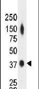 Creatine Kinase MB Antibody in Western Blot (WB)