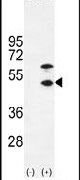 Creatine Kinase MB Antibody in Western Blot (WB)