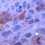 Cyclin B1 Antibody in Immunohistochemistry (IHC)