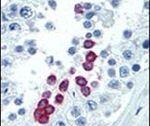 Cyclin D1 Antibody in Immunohistochemistry (IHC)
