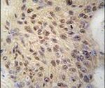 Cyclin D1 Antibody in Immunohistochemistry (IHC)