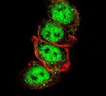 Cyclin D1 Antibody in Immunocytochemistry (ICC/IF)