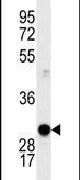 Cyclin D1 Antibody in Western Blot (WB)