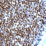 Cyclin D1 Antibody in Immunohistochemistry (IHC)