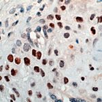 Cyclin E Antibody in Immunohistochemistry (IHC)