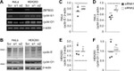 Cyclin E Antibody in Western Blot (WB)