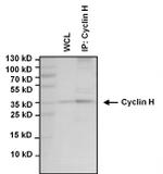 Cyclin H Antibody in Immunoprecipitation (IP)