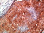 Cytokeratin 18 Antibody in Immunohistochemistry (Paraffin) (IHC (P))