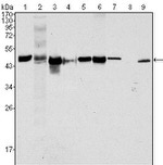 Cytokeratin 18 Antibody in Western Blot (WB)