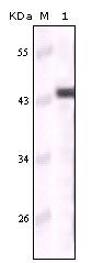 Cytokeratin 5 Antibody in Western Blot (WB)
