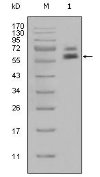 Cytokeratin 5 Antibody in Western Blot (WB)