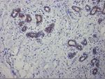 Cytokeratin 7 Antibody in Immunohistochemistry (Paraffin) (IHC (P))