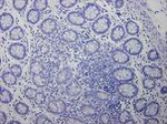 Cytokeratin 7 Antibody in Immunohistochemistry (Paraffin) (IHC (P))