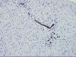 Cytokeratin 7 Antibody in Immunohistochemistry (Paraffin) (IHC (P))