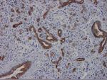 Cytokeratin 7 Antibody in Immunohistochemistry (Paraffin) (IHC (P))
