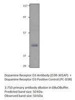 Dopamine Receptor D3 Polyclonal Antibody