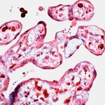 D4-GDI Antibody in Immunohistochemistry (IHC)