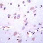 DRD5 Antibody in Immunohistochemistry (IHC)