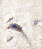 DAAM1 Antibody in Immunohistochemistry (IHC)