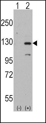 DAAM1 Antibody in Western Blot (WB)
