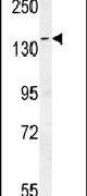 DAAM1 Antibody in Western Blot (WB)