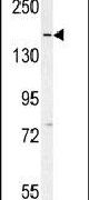 DAAM1 Antibody in Western Blot (WB)