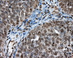 DAPK2 Antibody in Immunohistochemistry (Paraffin) (IHC (P))