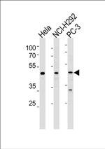 NR0B1 Antibody in Western Blot (WB)
