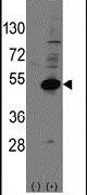 NR0B1 Antibody in Western Blot (WB)