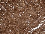 DBN1 Antibody in Immunohistochemistry (Paraffin) (IHC (P))
