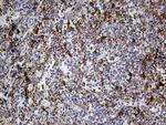 DBN1 Antibody in Immunohistochemistry (Paraffin) (IHC (P))