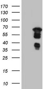 DBNL Antibody in Western Blot (WB)