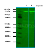 PARP1 SRM Antibody in Western Blot (WB)