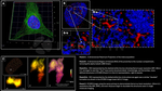 gamma-H2AX SRM Antibody in Immunocytochemistry (ICC/IF)