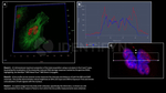 gamma-H2AX SRM Antibody in Immunocytochemistry (ICC/IF)
