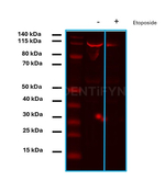 PARP1 SRM Antibody in Western Blot (WB)