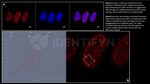 gamma-H2AX SRM Antibody in Immunocytochemistry (ICC/IF)