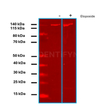 PARP1 SRM Antibody in Western Blot (WB)